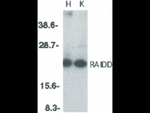 RAIDD Antibody in Western Blot (WB)