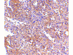 RAP80 Antibody in Immunohistochemistry (Paraffin) (IHC (P))