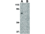RAP80 Antibody in Western Blot (WB)
