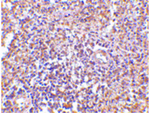 RAP80 Antibody in Immunohistochemistry (Paraffin) (IHC (P))