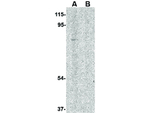 RAP80 Antibody in Western Blot (WB)