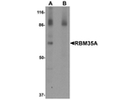 RBM35A Antibody in Western Blot (WB)