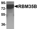 RBM35B Antibody in Western Blot (WB)