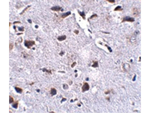 RCAN2 Antibody in Immunohistochemistry (Paraffin) (IHC (P))