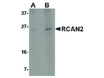 RCAN2 Antibody in Western Blot (WB)