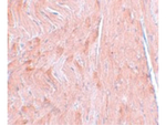 REEP3 Antibody in Immunohistochemistry (Paraffin) (IHC (P))
