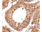 RGPD5 Antibody in Immunohistochemistry (Paraffin) (IHC (P))