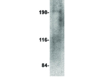 RGPD5 Antibody in Western Blot (WB)