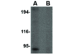 RGPD5 Polyclonal Antibody