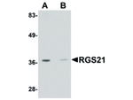 RGS21 Antibody in Western Blot (WB)