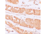 RHAMM Antibody in Immunohistochemistry (Paraffin) (IHC (P))