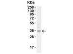 RHBDD1 Polyclonal Antibody