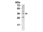 RHBDD1 Antibody in Western Blot (WB)