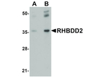 RHBDD2 Antibody in Western Blot (WB)