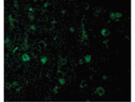 Rheb Polyclonal Antibody