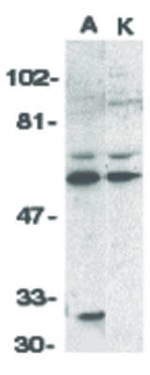 RICK Antibody in Western Blot (WB)