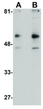 RICK Antibody in Western Blot (WB)