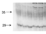Aquaporin 2 Antibody in Western Blot (WB)