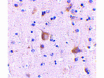 RIM2 Antibody in Immunohistochemistry (Paraffin) (IHC (P))