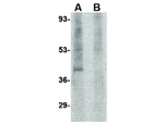RIM3 Polyclonal Antibody