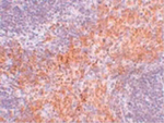 RIPK1 Antibody in Immunohistochemistry (Paraffin) (IHC (P))