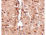 RKHD1 Antibody in Immunohistochemistry (Paraffin) (IHC (P))