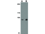 RKHD1 Antibody in Western Blot (WB)
