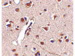 RKHD4 Antibody in Immunohistochemistry (Paraffin) (IHC (P))