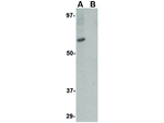 RKHD4 Antibody in Western Blot (WB)