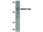 RNF168 Polyclonal Antibody