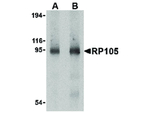 RP105 Antibody in Western Blot (WB)