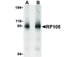 RP105 Antibody in Western Blot (WB)