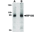 RP105 Antibody in Western Blot (WB)