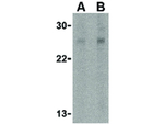 RPA Interacting Protein Antibody in Western Blot (WB)