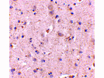 RPS6K1 Antibody in Immunohistochemistry (Paraffin) (IHC (P))