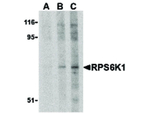 RPS6K1 Antibody in Western Blot (WB)