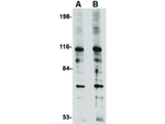 RPS6K1 Antibody in Western Blot (WB)