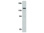 RRAS2 Polyclonal Antibody