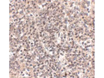 RSPO1 Antibody in Immunohistochemistry (Paraffin) (IHC (P))