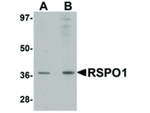 RSPO1 Antibody in Western Blot (WB)