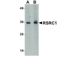 RSRC1 Antibody in Western Blot (WB)