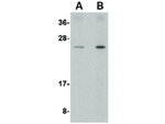 RTP801 Antibody in Western Blot (WB)