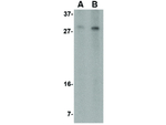 RTP801 Polyclonal Antibody