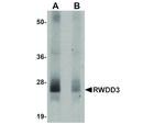 RWDD3 Polyclonal Antibody
