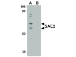SAE2 Antibody in Western Blot (WB)