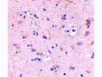 SAMHD1 Antibody in Immunohistochemistry (Paraffin) (IHC (P))