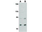 SAMHD1 Antibody in Western Blot (WB)