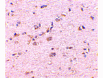 SAPAP1 Antibody in Immunohistochemistry (Paraffin) (IHC (P))