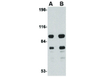 SAPAP1 Antibody in Western Blot (WB)