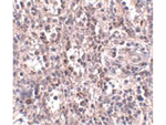 SCARB1 Antibody in Immunohistochemistry (Paraffin) (IHC (P))